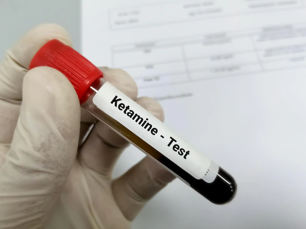 How important is set and setting when doing Ketamine treatments at home from the OnlineKetamineClinic